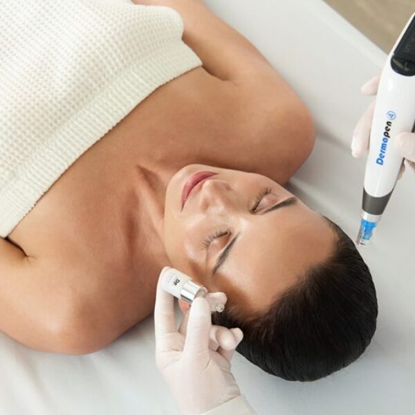 Dermapen Microneedling | Salon Perfect Face