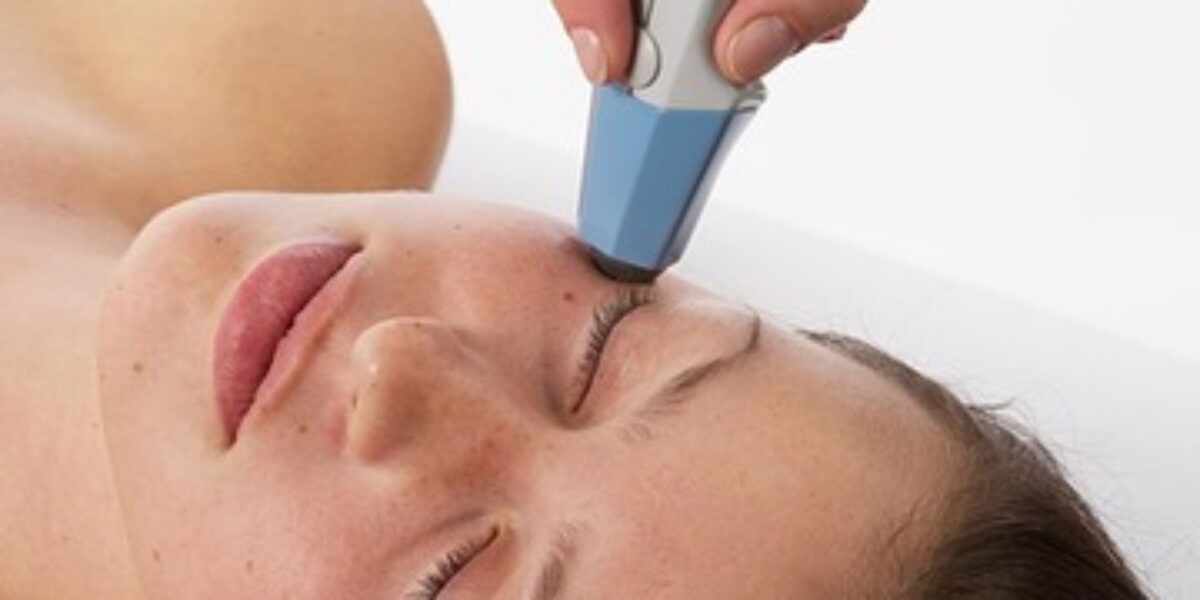 Radiofrequency wrinkles removing